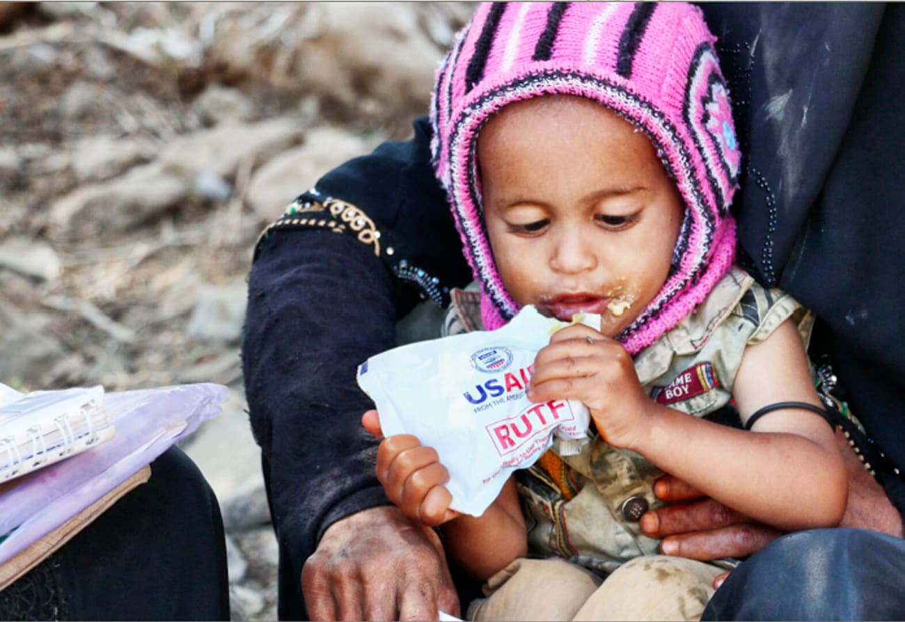malnutrition regions affected by conflict.